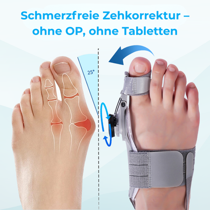 Medivitas™ Ballenzeh-Korrektur